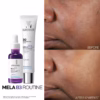 Mela B3 Serum Dark Spot Corrector