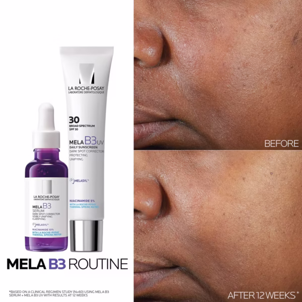 Mela B3 Serum Dark Spot Corrector