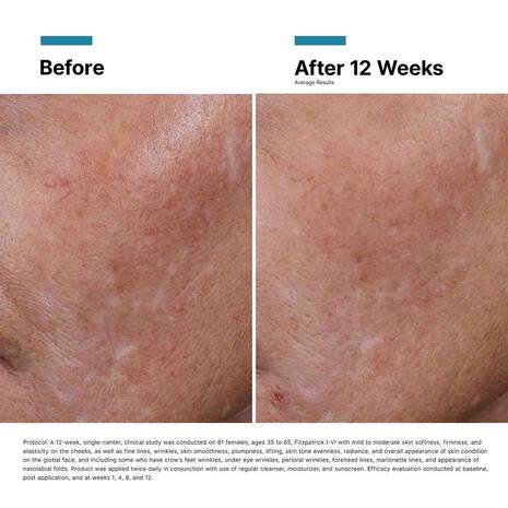 SkinCeuticals Hyaluronic Acid Intensifier Multi-Glycan 30 ml