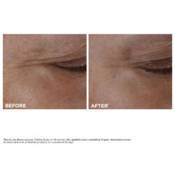 Clarins Total Eye Lift Eye Cream for Firming, Wrinkles, Dark Circles + Puffiness 0.5oz