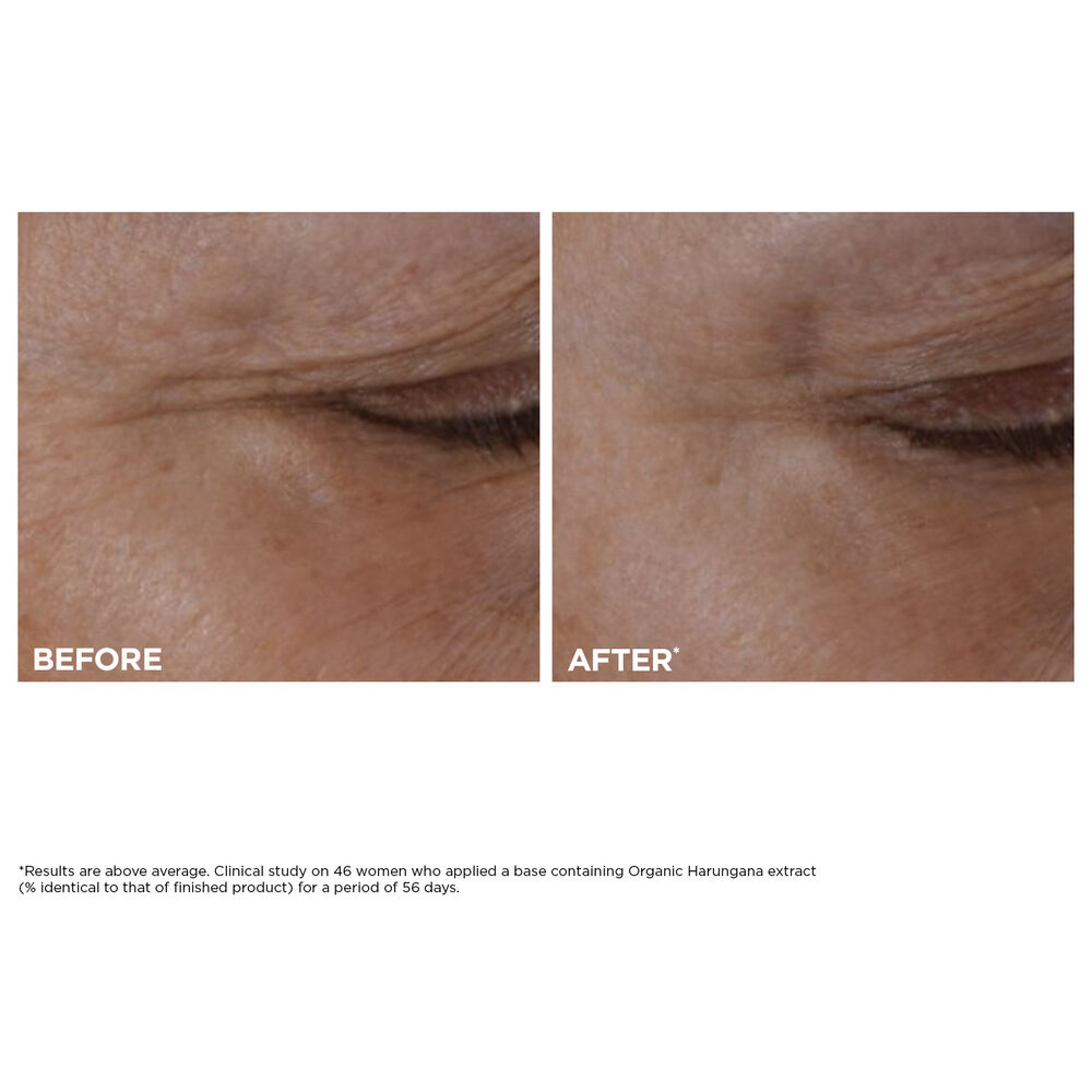 Clarins Total Eye Lift Eye Cream for Firming, Wrinkles, Dark Circles + Puffiness 0.5oz
